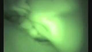 Sextape von Paris Hilton im Hotel